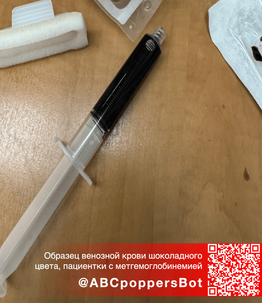 Если принять попперс внутрь в Волгограде это вызывает метгемоглобинемию. Смертельное состояние Если принять попперс внутрь в Волгограде это вызывает метгемоглобинемию. Смертельное состояние